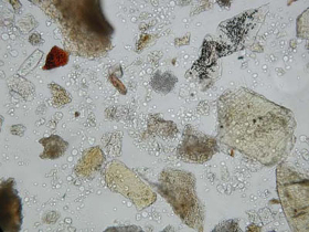 Frammenti di mangime al microscopio ottico (Foto: Agenzia provinciale per l’ambiente)