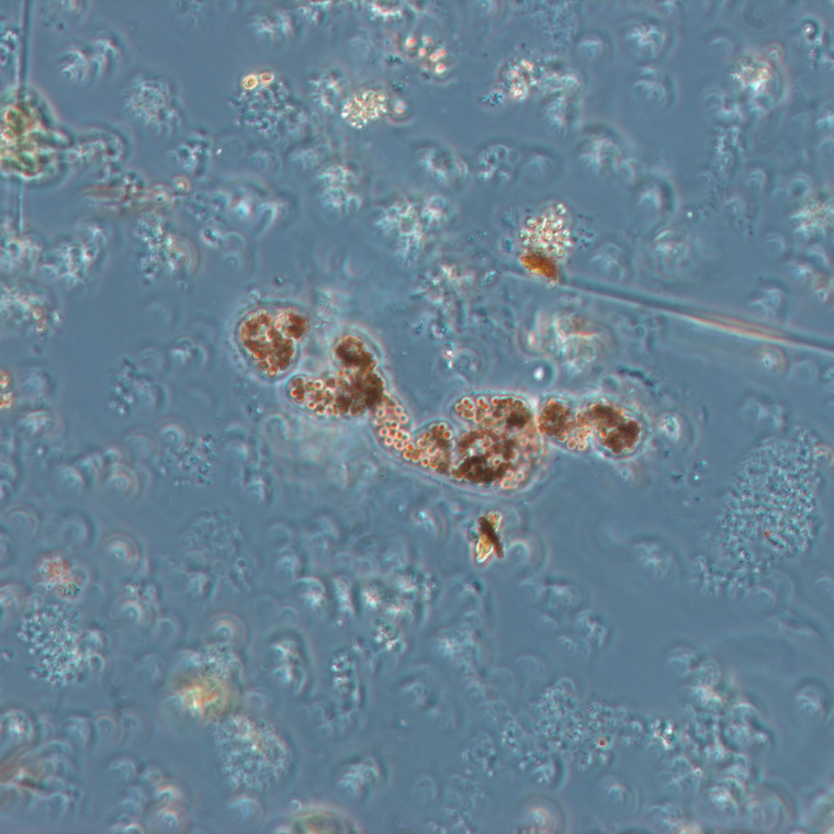 Immagine al microscopio ottico di una colonia di Microcystis wesembergii (Foto: Agenzia provinciale per l'ambiente e la tutela del clima, 2019)