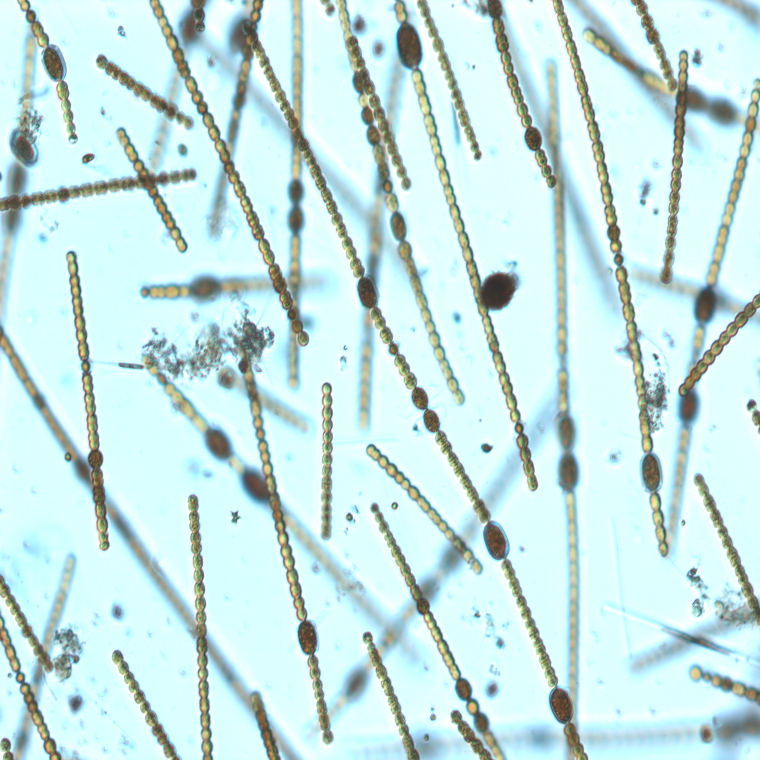 Immagine al microscopio ottico di colonie di Dolichospermum vigueri (Foto: Agenzia provinciale per l'ambiente e la tutela del clima, 2019) provinciale per l'ambiente e la tutela del clima, 2019)