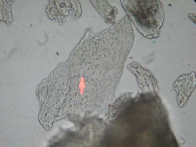 Frammento osseo al microscopio ottico (Foto: Agenzia provinciale per l’ambiente)