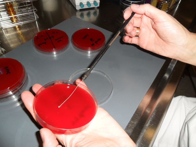 Striscio di un campione diluito su piastra di Petri con terreno di coltura (Foto: Agenzia provinciale per l’ambiente, 2015)