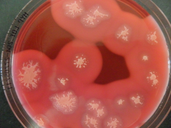 Piastra di Petri con colonie di Bacillus cereus (Foto: Agenzia provinciale per l’ambiente, 2015)
