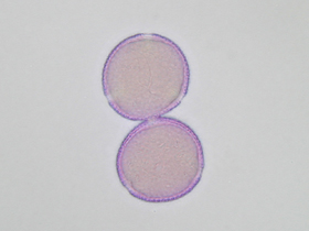 Immagine al microscopio ottico del polline di frassino comune colorato con fucsina: pollini in sezione ottica (Foto: Agenzia provinciale per l’ambiente, E. Bucher, 2002)