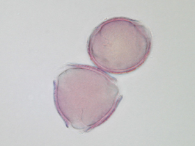 Immagine al microscopio ottico del polline di roverella colorato con fucsina, pollini in sezione ottica (Foto: Agenzia provinciale per l’ambiente e la tutela del clima, E. Bucher)