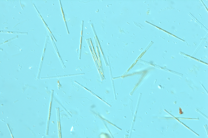Immagine al microscopio ottico: diatomee pelagiche, ingrandimento 400x (Foto: Agenzia provinciale per l'ambiente e la tutela del clima)