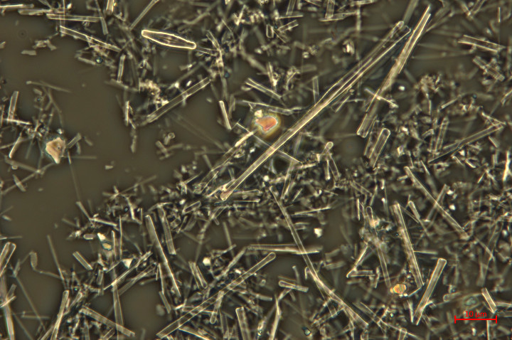 Immagine al microscopio ottico: frustoli di diatomee, spazzolati dalle pietre bianche, ingrandimento 1000x (Foto: Agenzia provinciale per l'ambiente e la tutela del clima)