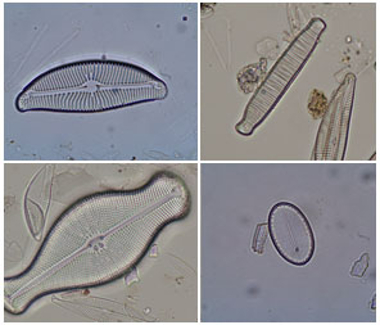 Diatomee al microscopio (Foto: Agenzia provinciale per l'ambiente)