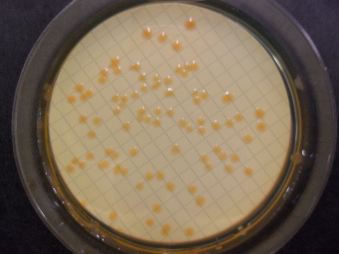 Analisi microbiologiche: Coliformi in acqua, piastra di Petri con colonie di Coliformi (Foto: Agenzia provinciale per l'ambiente)